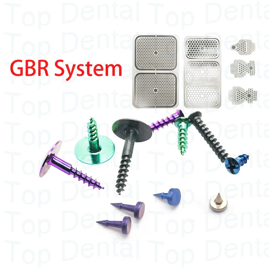 10 pz Dentale Sistema GBR Viti - Stabilizer Screw In recensione e prezzo